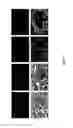 Fig. 02 - Pharmaceutical compositions comprising microparticles for delivery into neurons