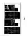 Fig. 06 - Pharmaceutical compositions comprising microparticles for delivery into neurons