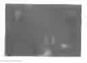 Fig. 01 - Cartilage composition for transplantation
