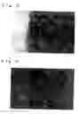 Fig. 04 - Cartilage composition for transplantation