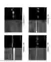 Fig. 14 - Method for restoration of gap junctional intercellular connection