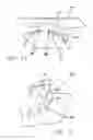 Fig. 08 - Low profile self-ligating bracket assembly and method of use