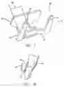 Fig. 03 - Low profile self-ligating bracket assembly and method of use