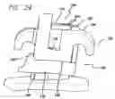 Fig. 15 - Low profile self-ligating bracket assembly and method of use
