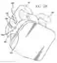 Fig. 19 - Low profile self-ligating bracket assembly and method of use