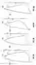 Fig. 06 - Endodontic instruments with pilot tips and parabolic cutting flutes