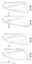 Fig. 08 - Endodontic instruments with pilot tips and parabolic cutting flutes