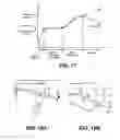 Fig. 16 - Swaggering endodontic instruments