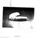 Fig. 03 - Combination dental mold and prosthesis