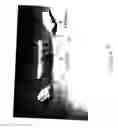 Fig. 04 - Combination dental mold and prosthesis