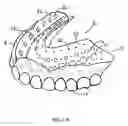 Fig. 02 - Denture