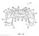 Fig. 03 - Denture