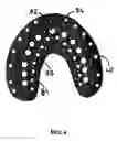 Fig. 05 - Denture