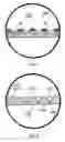 Fig. 08 - Denture