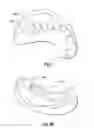 Fig. 06 - Dental post analogs
