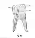 Fig. 08 - Dental post analogs