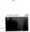 Fig. 04 - Methods for identifying small molecules that bind specific RNA structural motifs