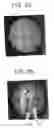 Fig. 04 - Arrays formed of encoded beads having oligonucleotides attached