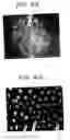 Fig. 07 - Encoded beads having oligonucleotides attached in arrays on a patterned surface
