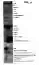 Fig. 04 - Novel RIP3 associated cell cycle proteins, compositions and methods of use