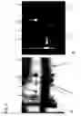 Fig. 03 - Method of detecting allergen protein
