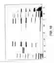 Fig. 12 - Chromatographic method and system for purifying a botulinum toxin