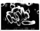 Fig. 04 - Microorganism capable of degrading aromatic polyester and method of degrading aromatic polyester using the same