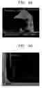 Fig. 07 - Cleaning solution and method of forming a metal pattern for a semiconductor device using the same