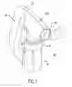 Fig. 02 - Bubble generating assembly