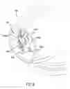 Fig. 10 - Bubble generating assembly