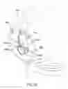 Fig. 11 - Bubble generating assembly