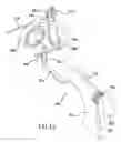Fig. 13 - Bubble generating assembly