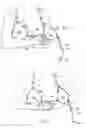 Fig. 04 - Cleavage-enhancing foundation garment