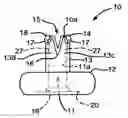 Fig. 01 - Sport item handle end cap