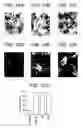 Fig. 18 - T. cruzi-derived neurotrophic agents and methods of use therefor