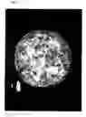 Fig. 09 - Water-absorbent resin, hydropolymer, process for producing them, and uses of them