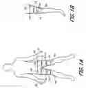 Fig. 02 - Suprapatellar external counterpulsation apparatus