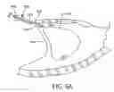 Fig. 07 - Method for cardiac restraint