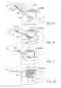 Fig. 11 - Method for cardiac restraint
