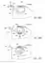 Fig. 14 - Method for cardiac restraint