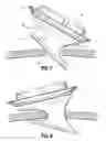 Fig. 07 - Surgical hand access apparatus
