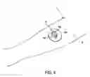 Fig. 04 - Adhesive fluorescence measurement patch