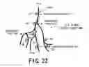 Fig. 22 - DIAGNOSTIC IMAGING SYSTEM AND IMAGE PROCESSING SYSTEM