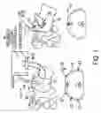 Fig. 02 - Automated chest compression apparatus with a bladder between the belt and the patient