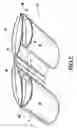 Fig. 03 - Rehabilitation device