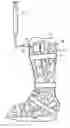 Fig. 01 - Orthopedic inlay