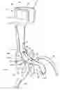Fig. 01 - Orthosis