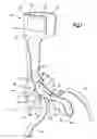 Fig. 02 - Orthosis