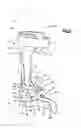 Fig. 03 - Orthosis