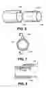 Fig. 09 - Arteriovenous access valve system and process